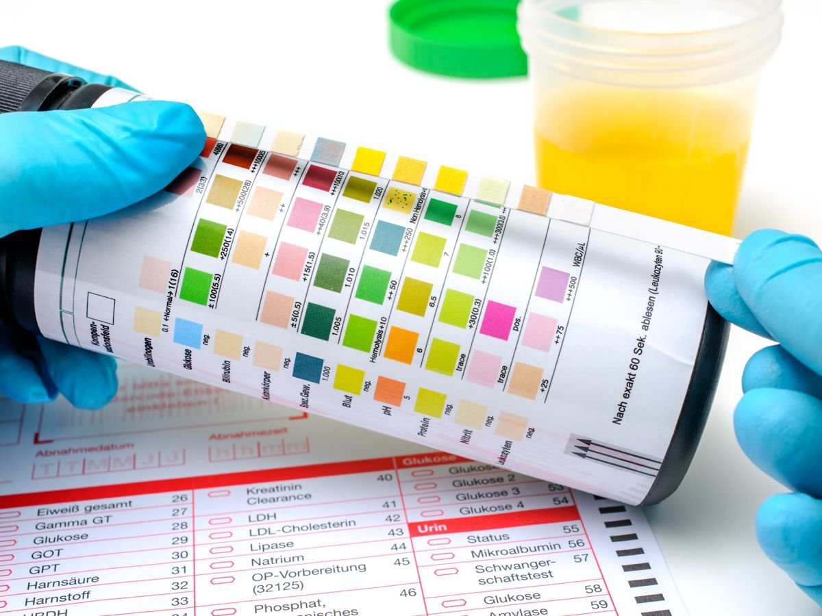 Biological Monitoring